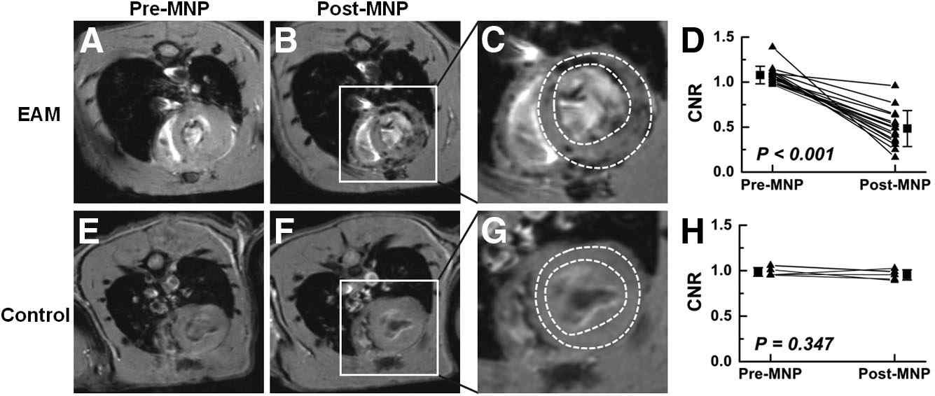 염증세포 표적 진단용 MRI/FI 다중 프로브를 꼬리정맥 주사한 지 24시간 후 심근염 염증의 크기 심장에서의 염증 크기에 따른 MR 영상, H&E, IHC 조직 염색 결과(A) 및 대조 대 잡음비 (CNR, contrast-to-noise ratio)의 측정 결과(B). 심근염 염증 심장의 H&E 및 IHC 염색 결과에서 각각의 염증 크기 및 대식세포 침윤 영역 크기에 따른 대조 대 잡음비 (CNR, contrast-to-noise ratio)의 변화(C, D)