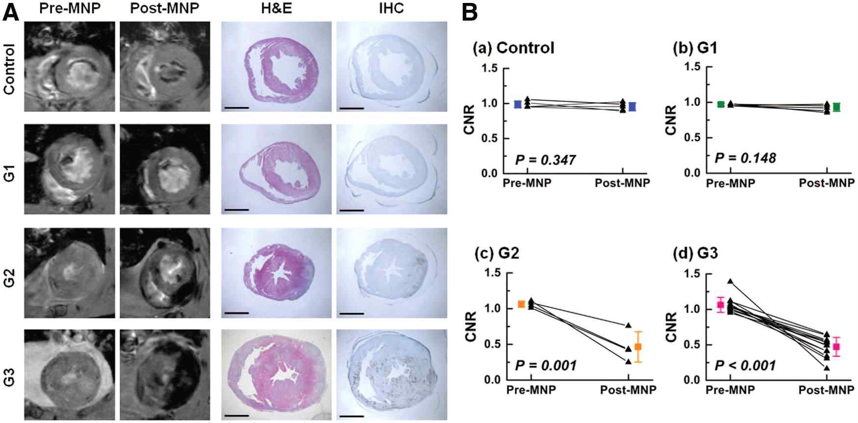 염증세포 표적 진단용 MRI/FI 다중 프로브를 꼬리정맥 주사한 지 24시간 후 심근염 염증의 크기 심장에서의 염증 크기에 따른 MR 영상, H&E, IHC 조직 염색 결과(A) 및 대조 대 잡음비 (CNR, contrast-to-noise ratio)의 측정 결과(B). 심근염 염증 심장의 H&E 및 IHC 염색 결과에서 각각의 염증 크기 및 대식세포 침윤 영역 크기에 따른 대조 대 잡음비 (CNR, contrast-to-noise ratio)의 변화(C, D)