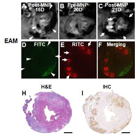 염증세포 표적 진단용 MRI/FI 다중 프로브를 이용한 생체 내 염증 진행 과정 관찰 결과(A, B, C) 및 조직 검사 결과(H, I). 같은 개체 내에 시기를 달리 하여 각각 서로 다른 형광물질이 코팅된 다중 프로브를 주사하여 형광 현미경으로도 관찰함(D, E, F).