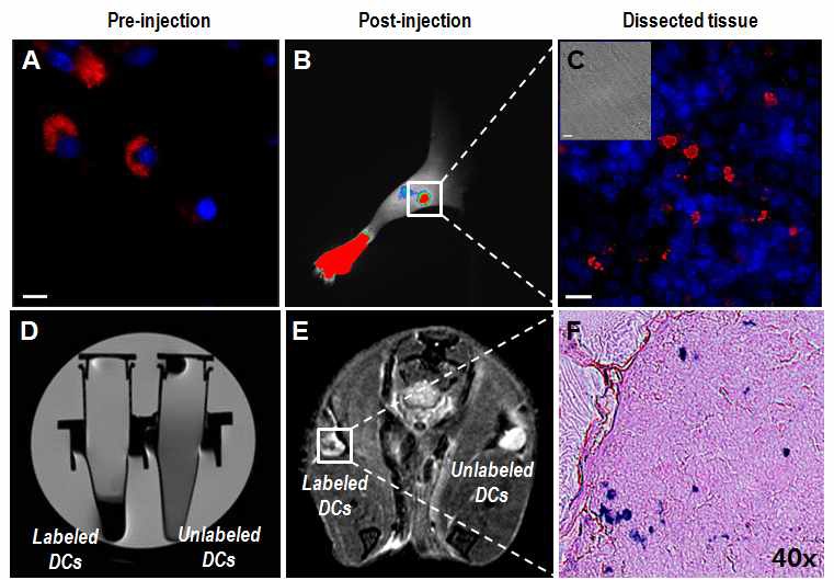 수지상세포에 self-fluorescent MR/optical 나노조영제를 처리한 후 세포의 형광 이미지 (A)와 세포 pallet의 MR 이미지(D). 조영제로 표지된 수지상 세포를 마우스 footpad에 주입하여 이동경로를 in vivo 형광이미지(B)와 MRI 영상(E). 림프노드 조직을 적출하여 형광이미지 (C)와 prussian blue 염색(F)으로 확인