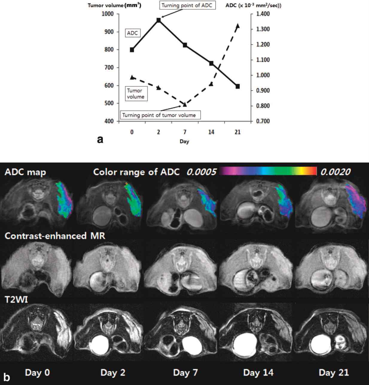 항암제 투여 후 종양의 ADC 값 및 크기 변화 (a), 이에 상응하는 MR 영상 (b).