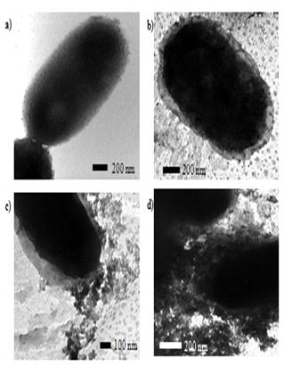 그림 3.1.12 투과주사현미경을 이용하여 관찰한 대장균의 모습