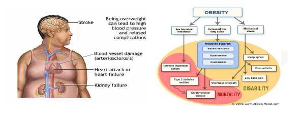 그림 3. 심혈관 관련 병증과 비만 (자료 : Nutrition Business Journal, 2006