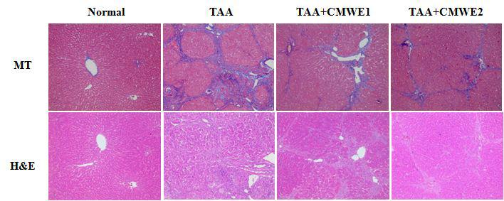 흰쥐에서 TAA로 유발한 간 섬유화에 대한 CMWE의 효과.간조직을 Masson