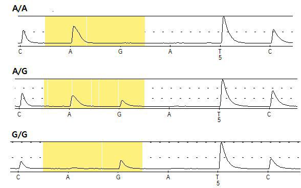 TBC1D21의 exon1SNP유전자형을 확인하기 위한 pyrosequencing결과.