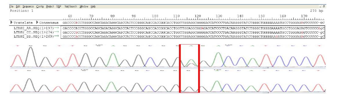 LTBP2exon13에서 확인된 SNP.
