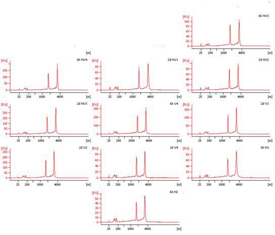 Electropherogram (peak pattern) of samples listed in Table 1.