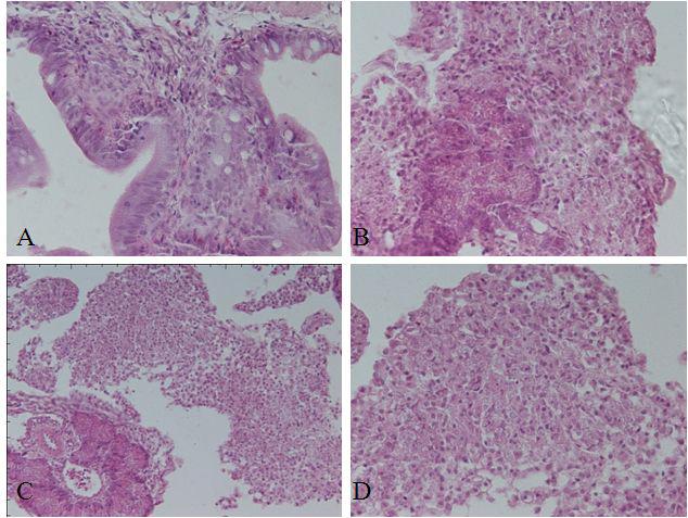 Histology of 7 days after injection with 10mg/1ml of Alum. intestine (A), Clump of inflammatory cells around pancreas (B) and abdominal cavity (C, D).