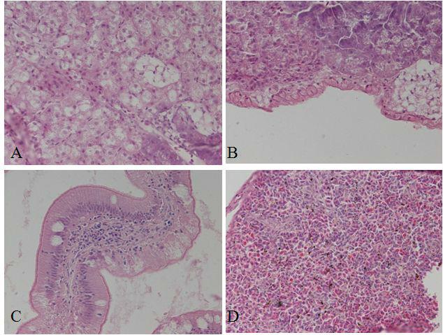 Histology of 15 days after injection with 10% of squalene showing lipoid degeneration in liver and inflammatory responses (B, C). Spleen was normal (D)