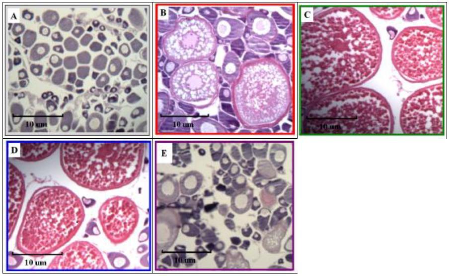 Changes in gonad histology of the yellowtail damselfish (Chrysiptera parasema)under lighting conditions using a simulated natural photoperiod (SNP)(A),red(B),green(C),blue(D),purple(E)LED lights.