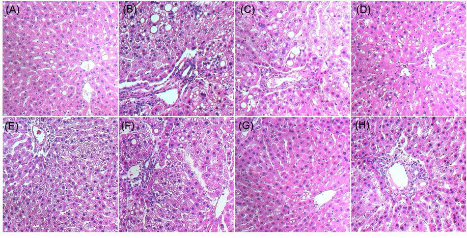 Effect of Agrimonia on histological changes in chronic ethanol-fed rat (Hematoxylin and eosin staining).