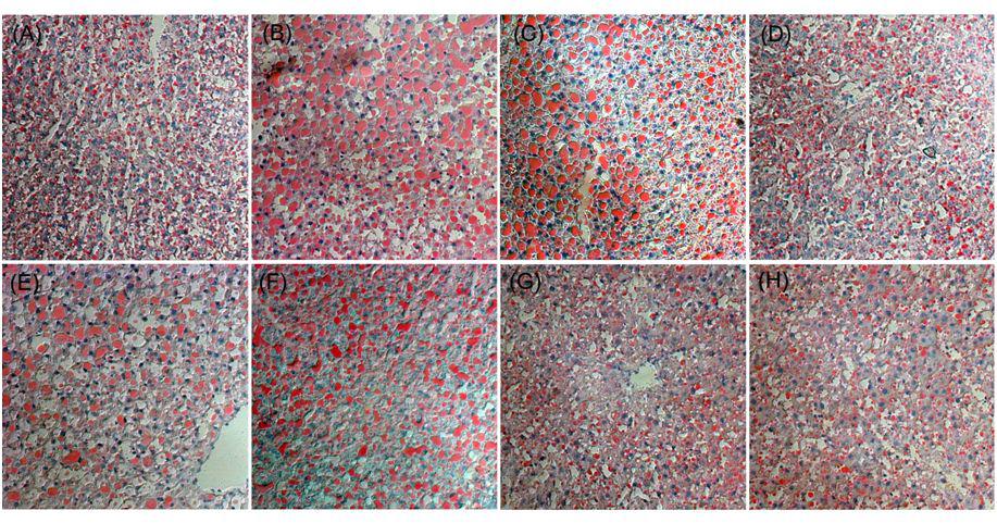 Effect of Agrimonia on fat accumulation in chronic ethanol-fed rat (Oil Red O staining).