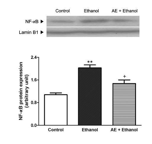 Effects of AE (30 mg/kg) on the nuclear NF-κB translocation.