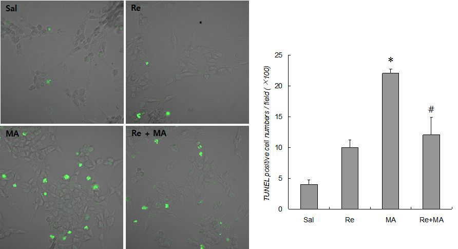 HumanneuroblastomaSH-SY5Y cell에 대 한 Ginsenoside Re의 MA 독성에 대한 보호효과 (TUNEL staining)