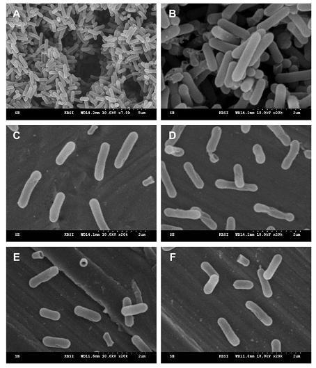 Scannin gelectron microscopy(SEM) images of L.monocytogenes bio films formedon the stainless steel coupons in the control (no HHP treatment,TSB,pH 7.0;A andB), TSB atpH 7.0withoutnisin(TSB7–N;C),TSB atpH 7.0withnisin(1000IU/ml, TSB7+N;D),TSB atpH 5.0withoutnisin(TSB5–N;E),andTSB atpH 5.0with nisin(1000IU/ml,TSB5+N;F).