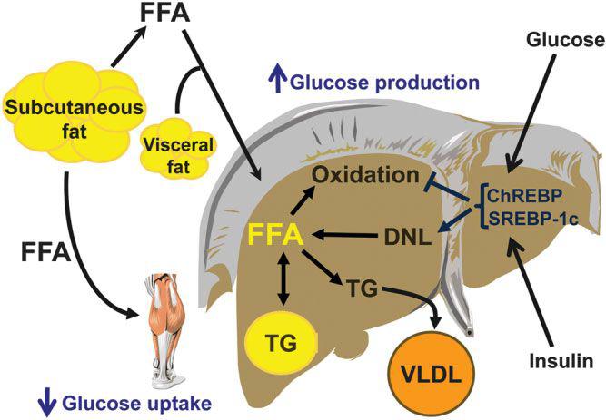 지방산에 의한 NAFLD 생성