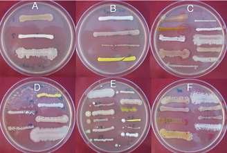 Observation of bacterial colony isolated.