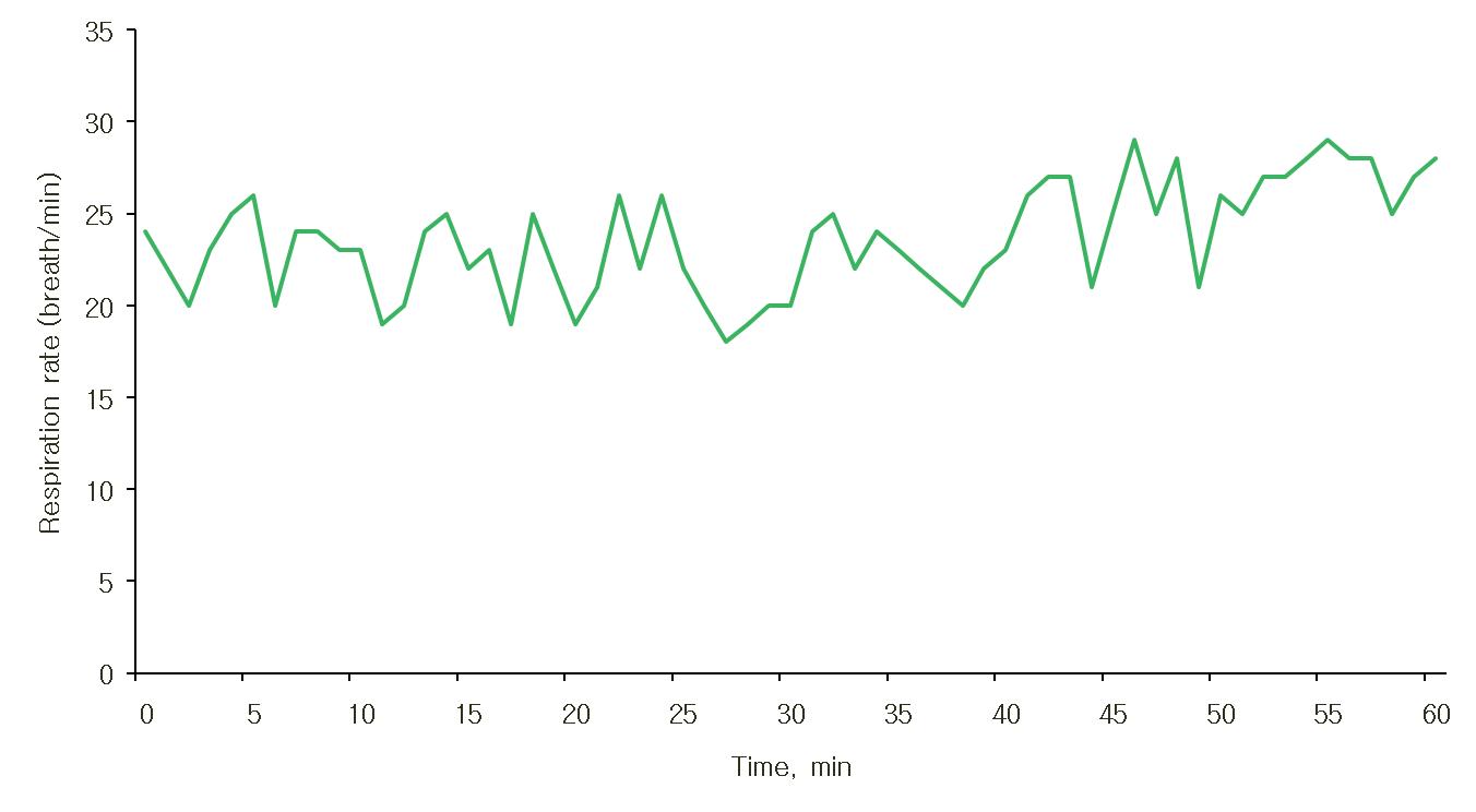 Change of respiration rate during cherry tomato harvesting