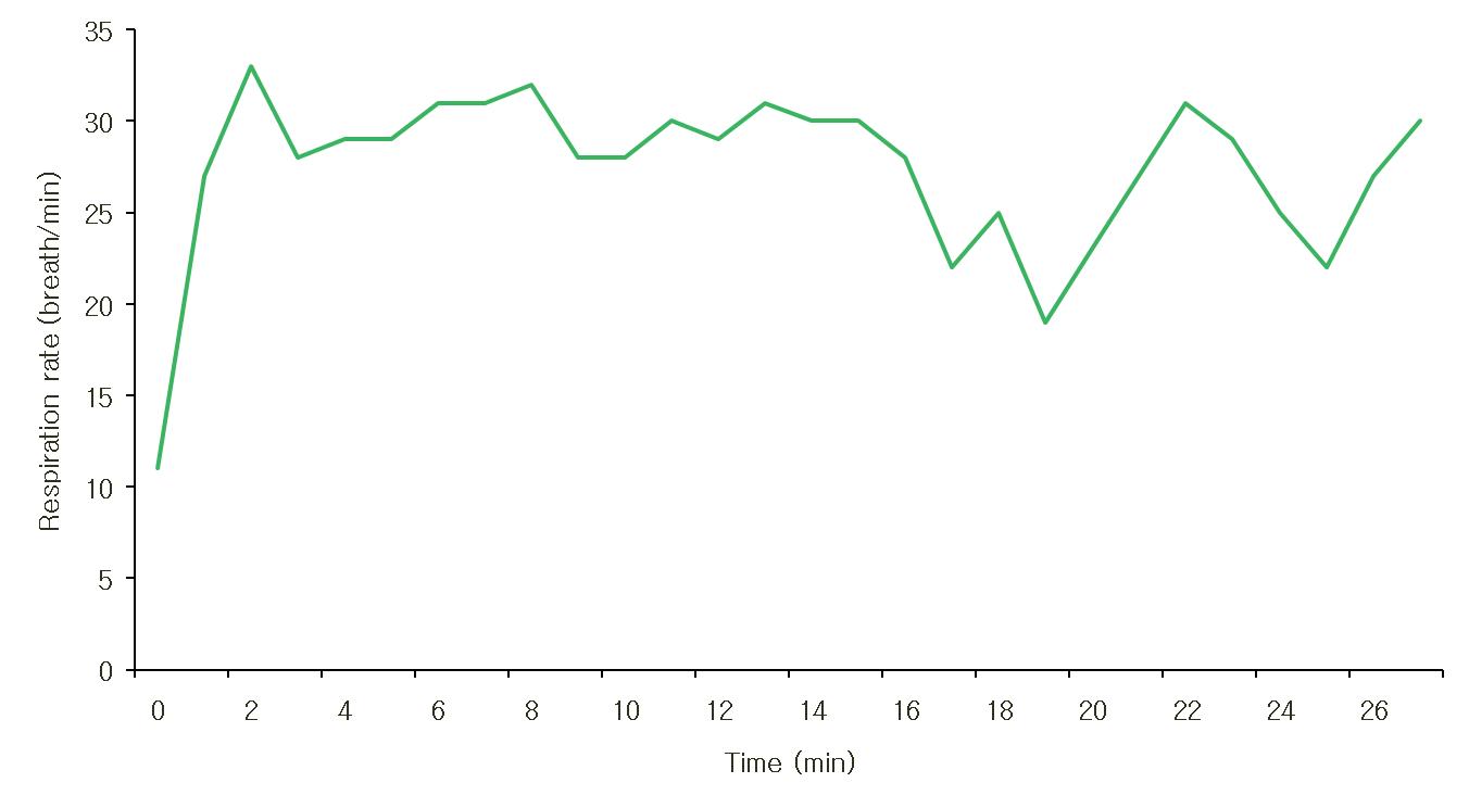 Change of respiration rate during lettuce-harvesting using fast response temperature sensor