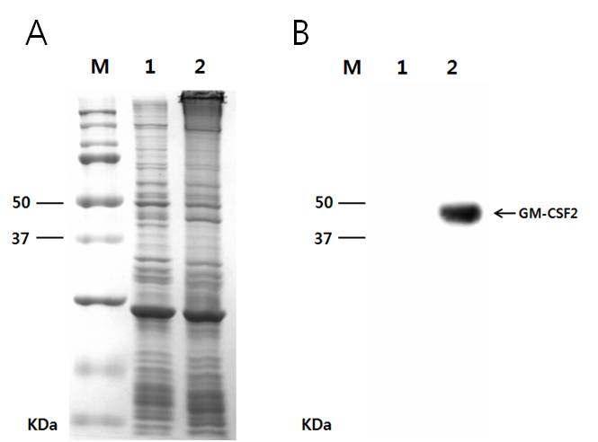 Western blot analysis for GM-CSF2 expression in the cocoon of transgenic silkworm