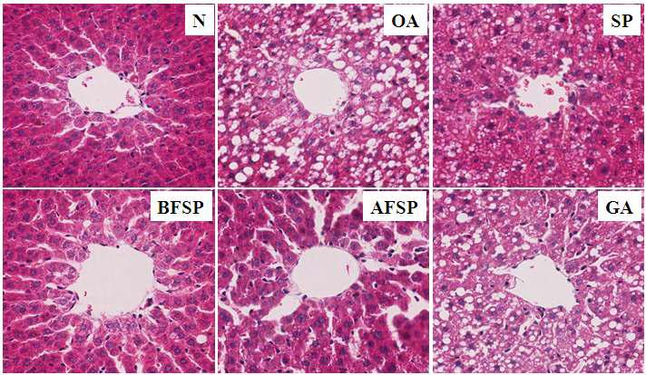 Effects of SP, BFSP, AFSP, and GA on the hepatic histopathologic changes in orotic acid feeding rats