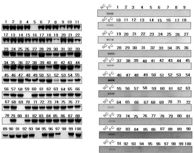 유전자 수평이동성 분석. 왼쪽: 토양미생물로부터 16S rDNA 검출, 오른쪽: 비타민A 강화벼 근권토양 우점미생물로부터 2A-TP 염기서열을 이용한 PCR 분석