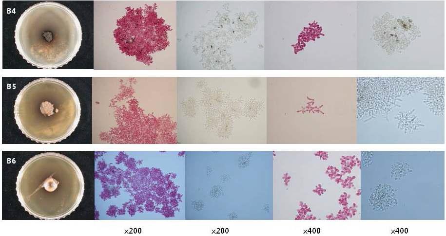 사과 갈색무늬병균(Marssonina mali) colony 색깔별 병원성 검정. B4, Mm YJ01, 강병원성; B5, Mm MJ02, 중 병원성; B6, GW06, 비병원성.