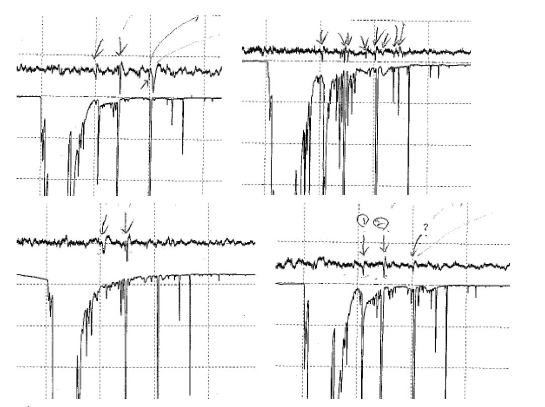 Examples of GC-EAD traces of New Zealand leafroller females. Top traces show antennal responses and bottom traces GC FID profiles.