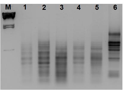 TRIzol method를 이용하여 Total RNA를 추출한 후 1% agarose gel