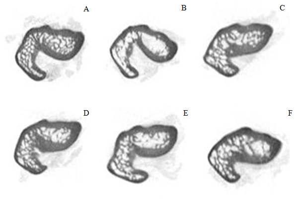 우측 대퇴골의 Micro-CT 결과