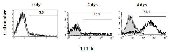 마크로파지세포에서의 TLT-6 단백질 발현 세포군의 변화양상 분석