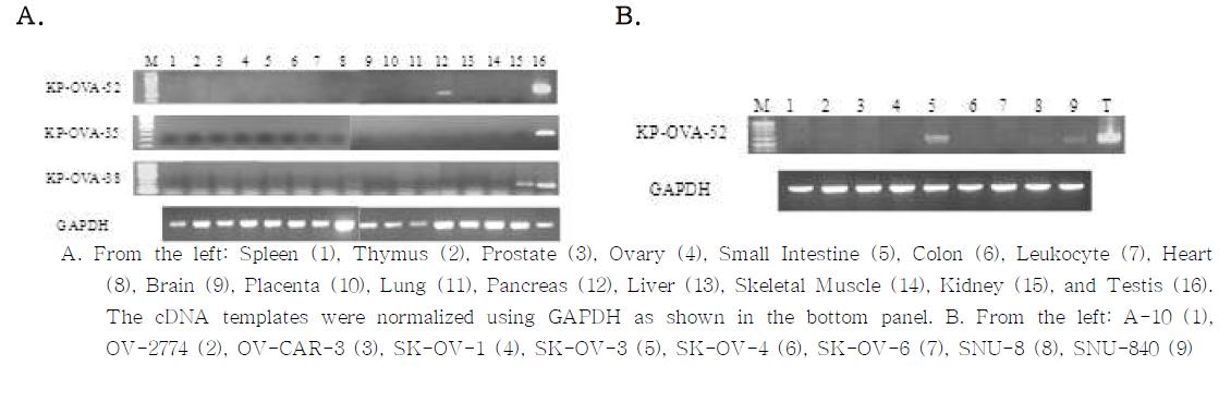 Conventional RT-PCR analysis of antigens in normal tissues and ovarian cancer lines