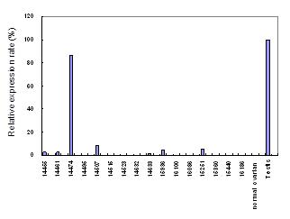 Quantitative real-time RT-PCR analysis of mRNA expression in ovarian tumors