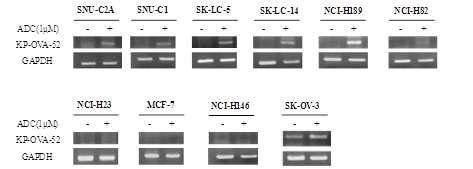 The mRNA expression of KP-OVA-52 in cancer cell lines