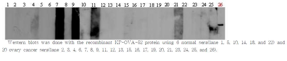 Frequent detection of anti KP-OVA-52 antibodies in sera from ovarian cancer patients by western blots