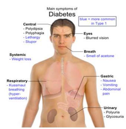 당뇨병의 일반적 증상
