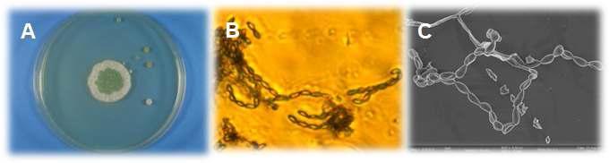 분리된 곰팡이 SDSe의 배지증식상 (A ), 위상차 현미경 400 배 (B), 전자현미경 2000 배 (C) 사진