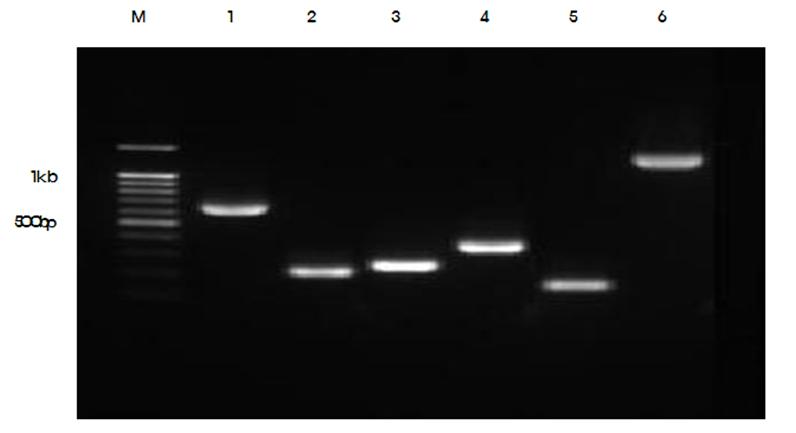 Agarose gel (1.5%) electrophoresis of PCR products obtained with specific primers for the cry genes.