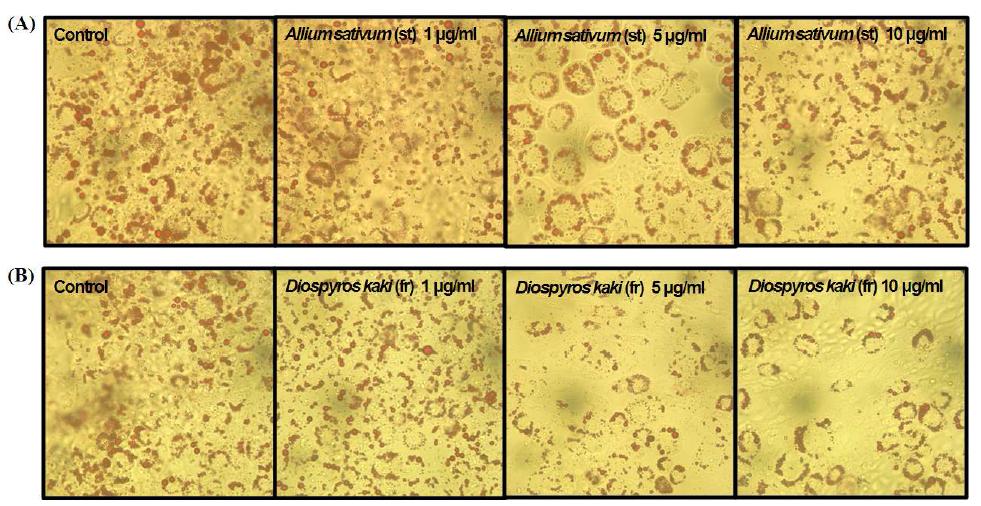 Light micrography of triglyceride (TG) accumulation in differentiated 3T3-L1 preadipocytes treated with Allium sativum L.(stem) and Diospyros kaki L.(fruit) (×200).
