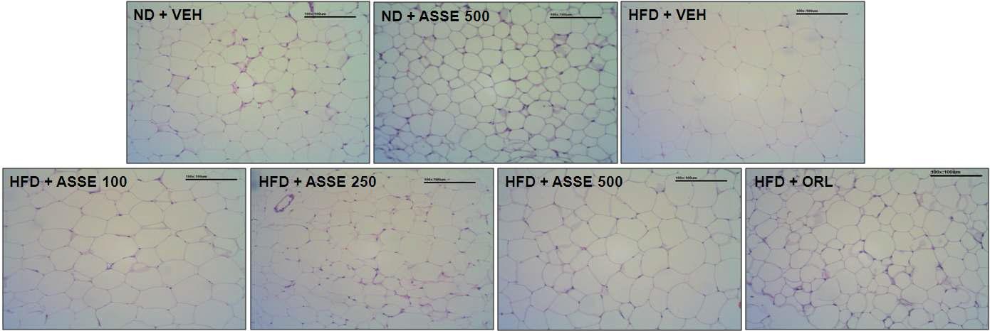 Micrography of epididymal adipocytes in obese mice induced by a high-fat diet (x100).