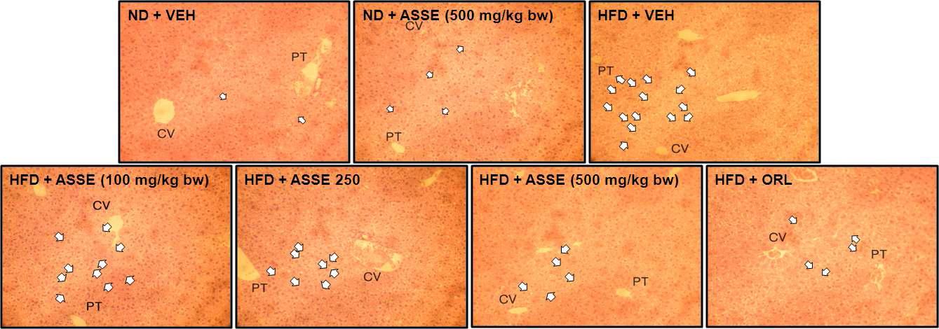 Micrography of hepatic tissue morphology in obese mice induced by a high-fat diet (x100).