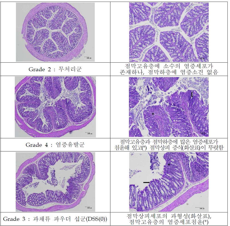 대장염 유발 동물 모델의 대장염 염증세포 조직학적 관찰