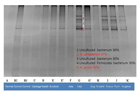 Distribution of intestinal microflora by PCR-DGGE analysis