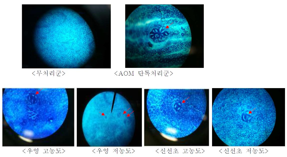 대장암 유발 동물 모델의 이상조직 및 이상함몰