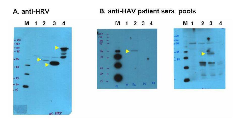 곤충세포에서 발현된 재조합단백질 항원에 대한 HRV 토끼혈청 및 HAV 감염환자혈청 반응의 Western blot 분석.