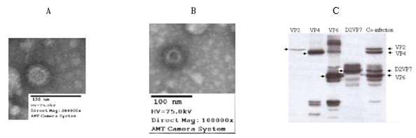 A형 간염바이러스 항원을 함유한 로타바이러스의 바이러스 유사입자(VLP)를 관찰한 결과.