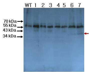 Western blot 분석에 의한 A형 간염 바이러스 항원단백질(VP1) 발현 확인.