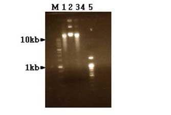 Recipient 와 transconjugnts의 plasmid profile.