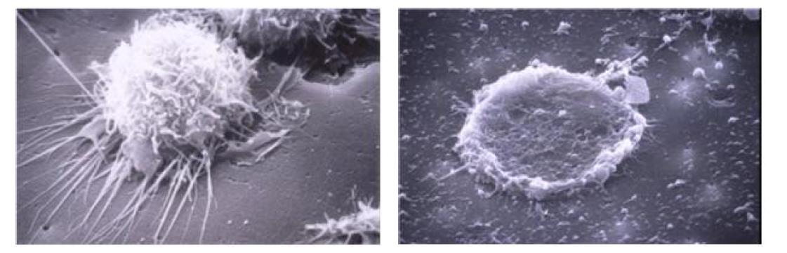 Change of cell shape according to PRRS infection(Healthy lung defense cell(left), PRRS-infected dead lung defense cell)