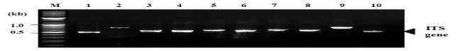 Detection of ITS region from the isolated yeast-like fungi by PCR.